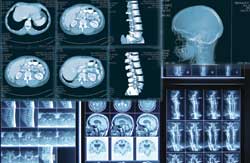 CT Scan Near Me | X Ray Near Me | X Ray Consultants